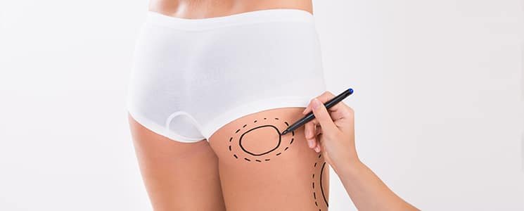 Butt Fat Transfer in Dubai: Why It’s Becoming a Popular Choice